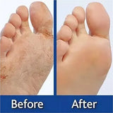 Crema Exfoliante para Pies